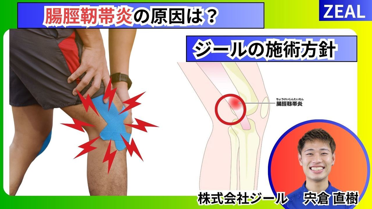 腸脛靱帯炎