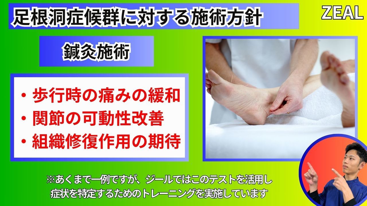 岡山県玉野市田井３丁目１１８８−１｜ジール鍼灸整骨院玉野院｜足根洞症候群の施術方法