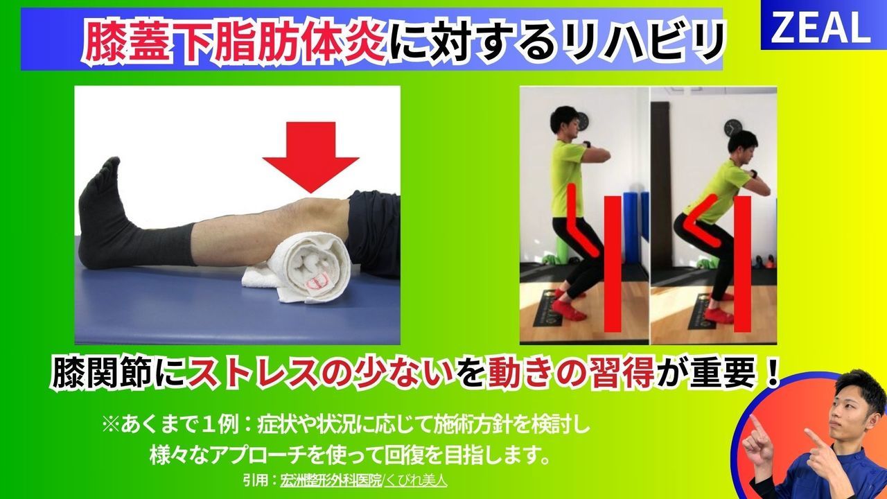 膝蓋下脂肪体に対するリハビリ｜玉野市ジール鍼灸整骨院