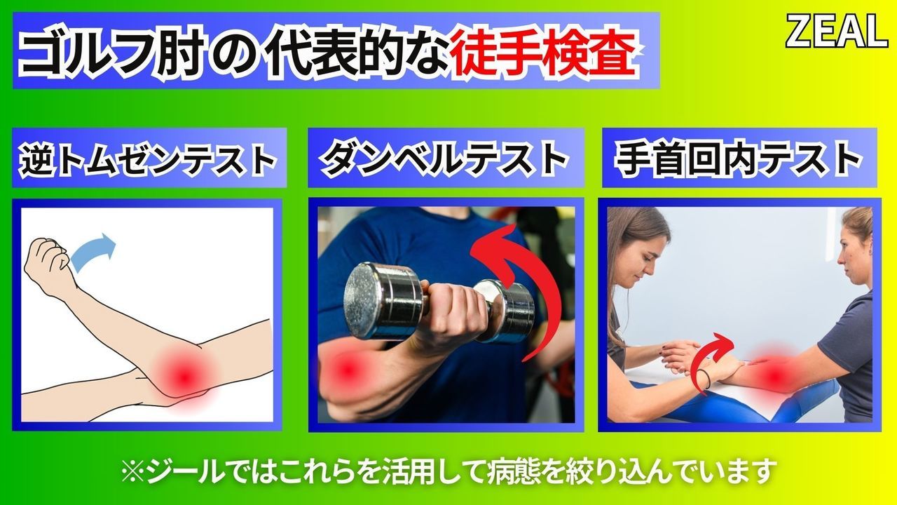 ゴルフ肘（上腕骨内側上顆炎）の検査方法｜玉野市ジール鍼灸整骨院