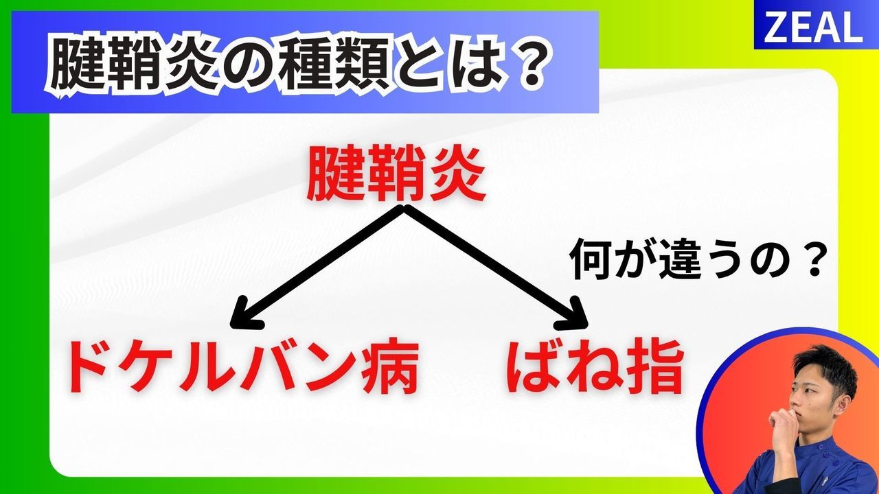 腱鞘炎（ばね指・ドケルバン病）の種類｜玉野市ジール鍼灸整骨院