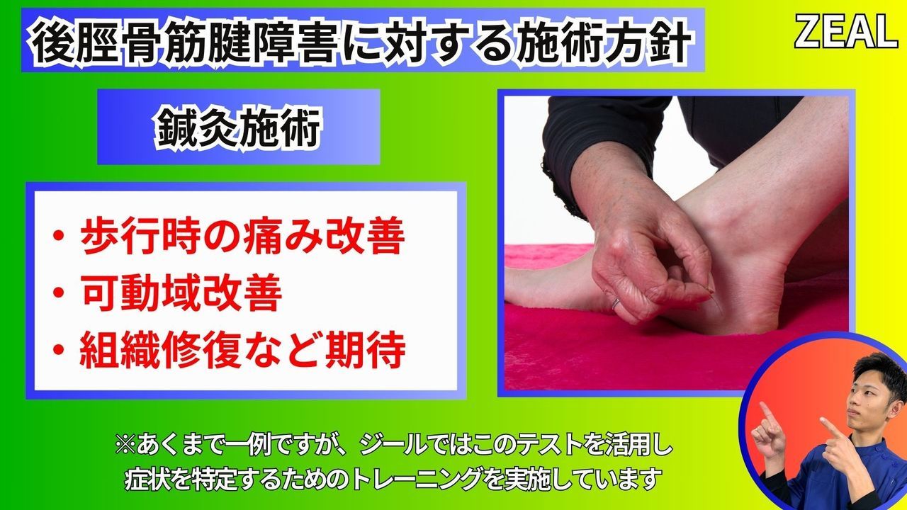 後脛骨筋腱障害の施術方針（鍼灸）