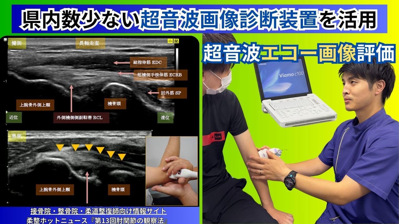 腱鞘炎（ばね指・ドケルバン病）のエコー診断｜玉野市ジール鍼灸整骨院