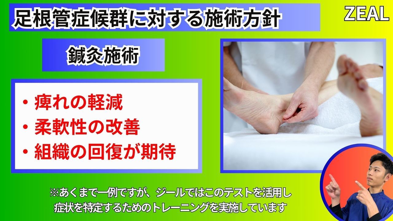 岡山県玉野市田井３丁目１１８８−１｜ジール鍼灸整骨院玉野院｜足根管症候群の施術方法