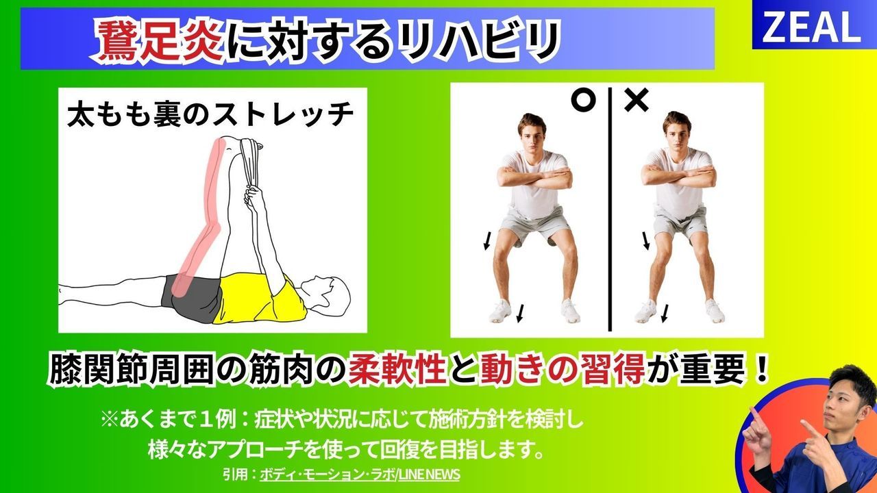 鵞足炎に対するリハビリ｜玉野市ジール鍼灸整骨院