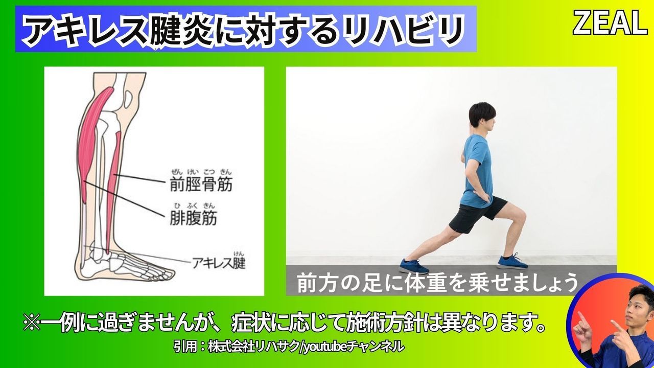 アキレス腱炎のセルフケア｜玉野市ジール鍼灸整骨院