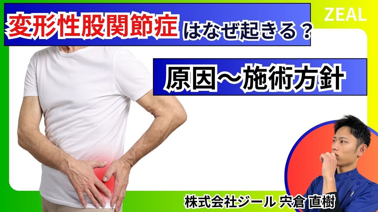 変形性股関節症｜玉野市ジール鍼灸整骨院