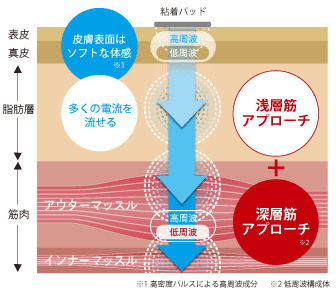 フィジオEMS｜玉野市ジール鍼灸整骨院
