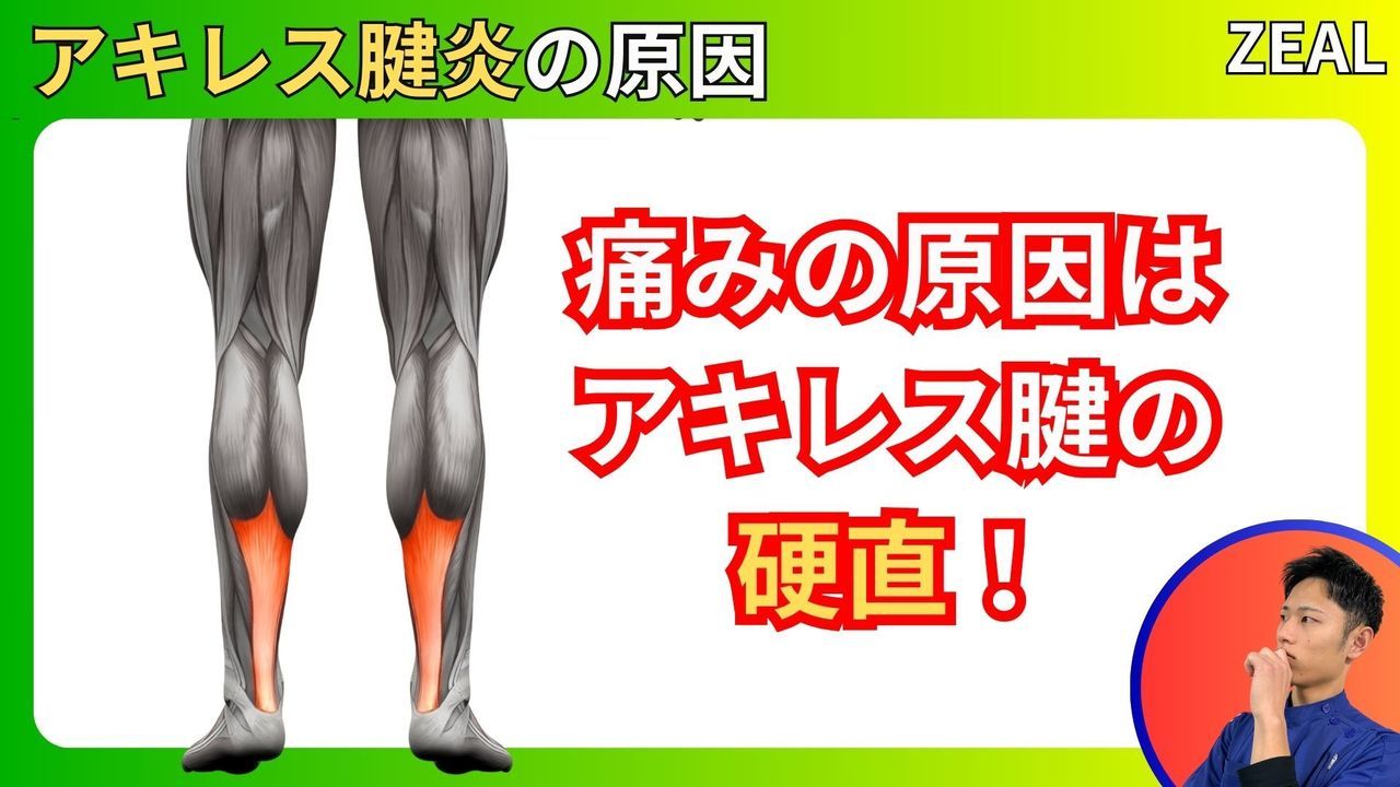 アキレス腱炎の原因｜玉野市ジール鍼灸整骨院