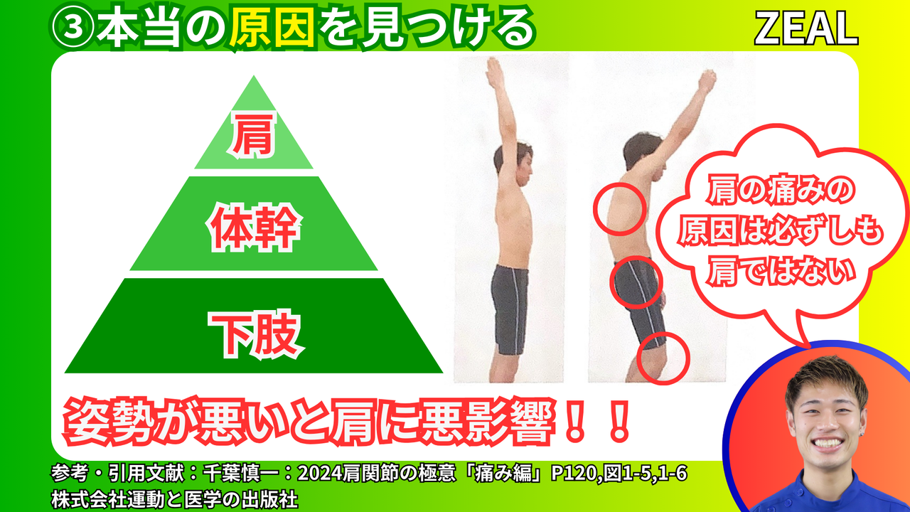 四十肩・五十肩の原因｜玉野市ジール鍼灸整骨院