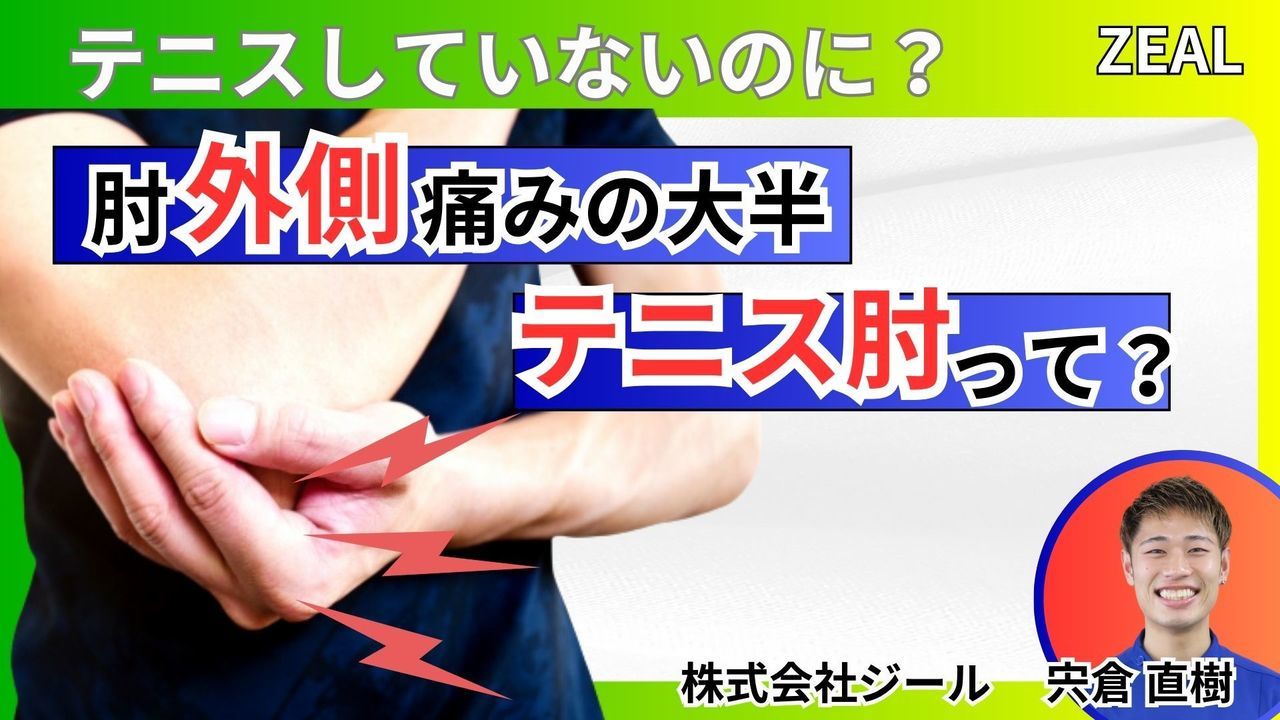 テニス肘（上腕骨外側上顆炎）｜玉野市ジール鍼灸整骨院