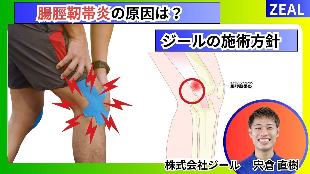 ランナー膝・腸脛靭帯炎の原因とは？｜玉野市ジール鍼灸整骨院