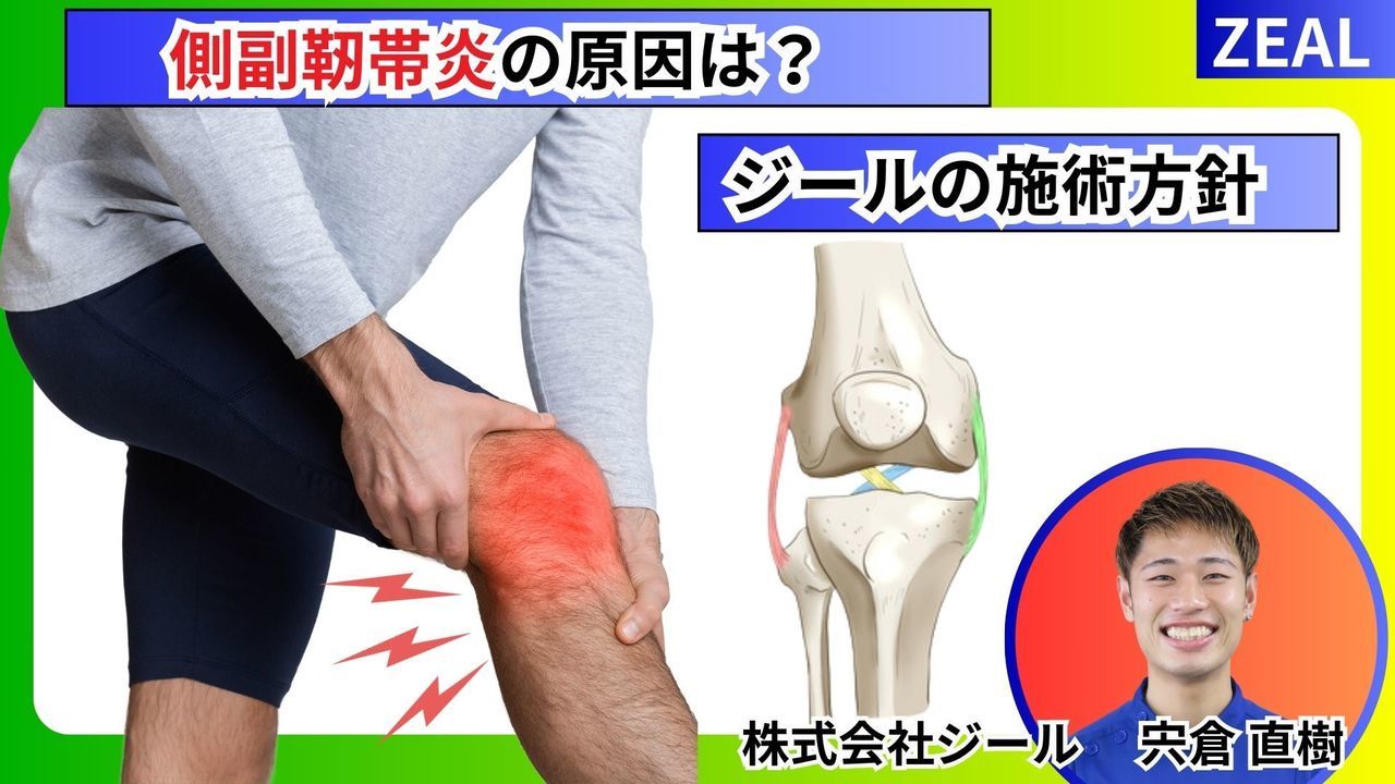 内側側副靱帯の原因｜玉野市ジール鍼灸整骨院