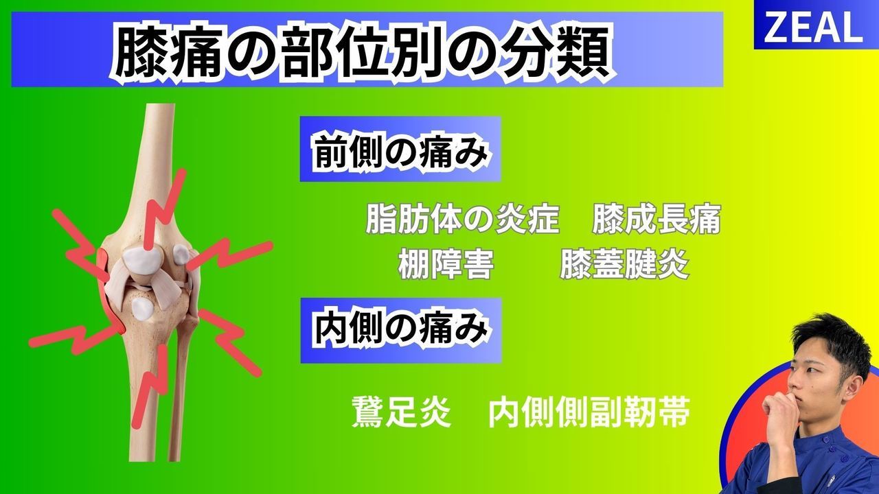 変形性膝関節症の分類｜玉野市ジール鍼灸整骨院