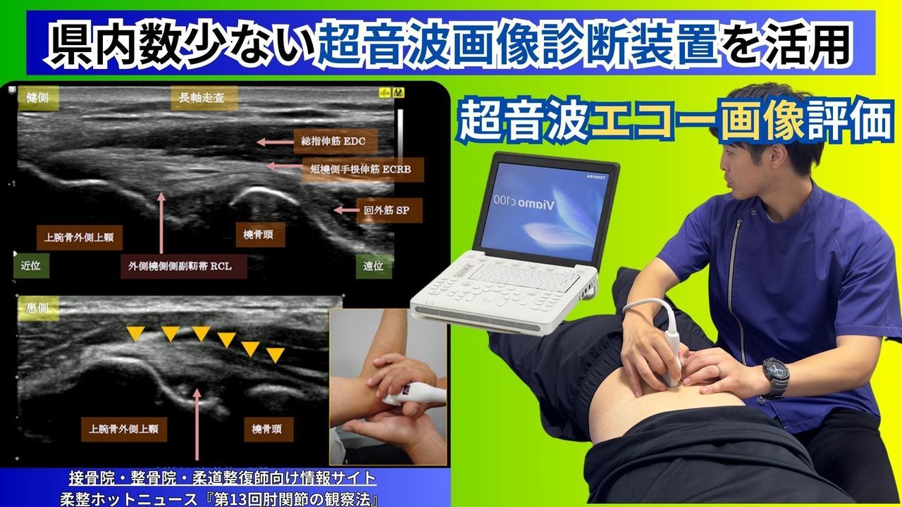 腰痛（ぎっくり腰）のエコー診断｜玉野市ジール鍼灸整骨院