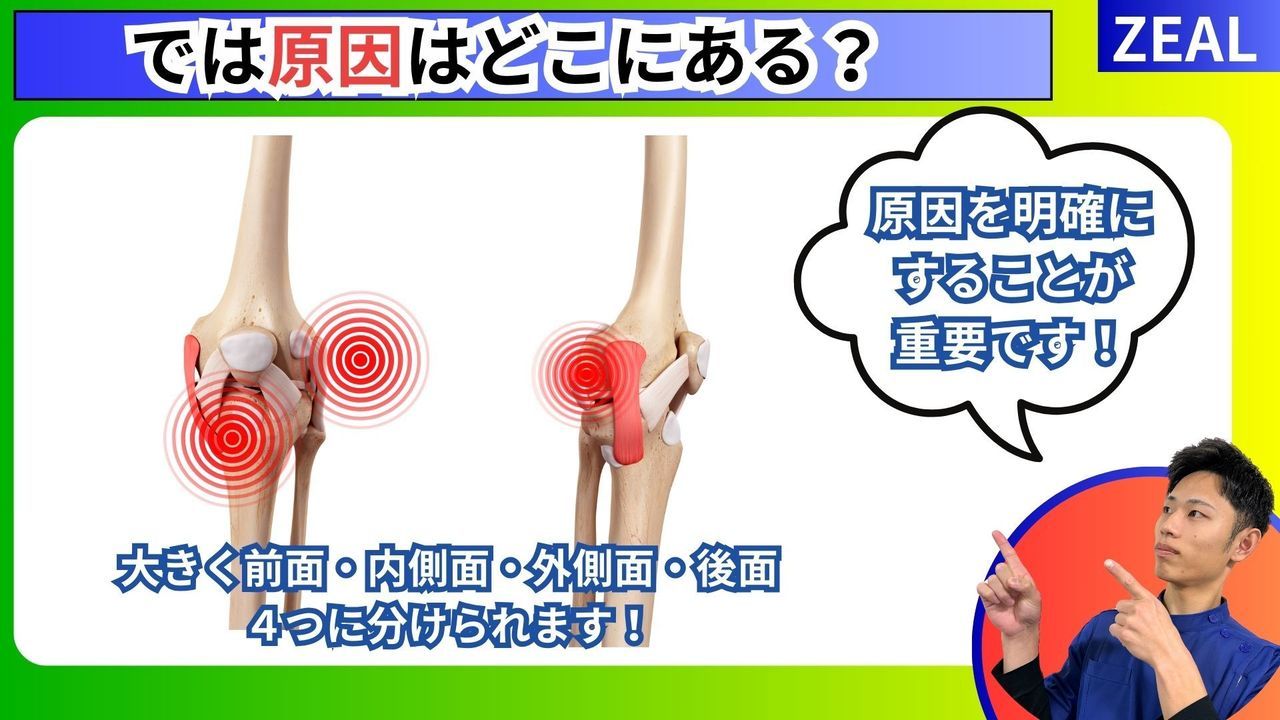 変形性膝関節症の原因｜玉野市ジール鍼灸整骨院