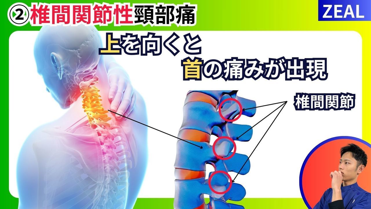 首の痛み頸部痛｜玉野市ジール鍼灸整骨院