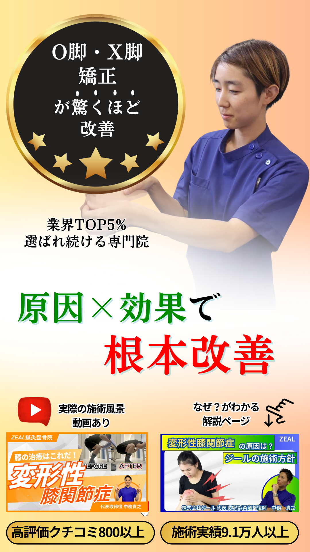 O脚・X脚が改善|玉野市田井ジール鍼灸整骨院