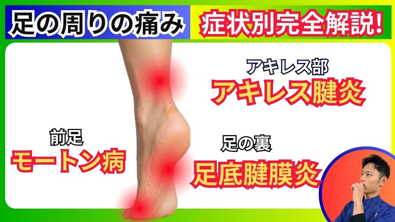 足の裏の痛み（足底腱膜炎・モートン・アキレス腱炎）｜玉野市ジール鍼灸整骨院