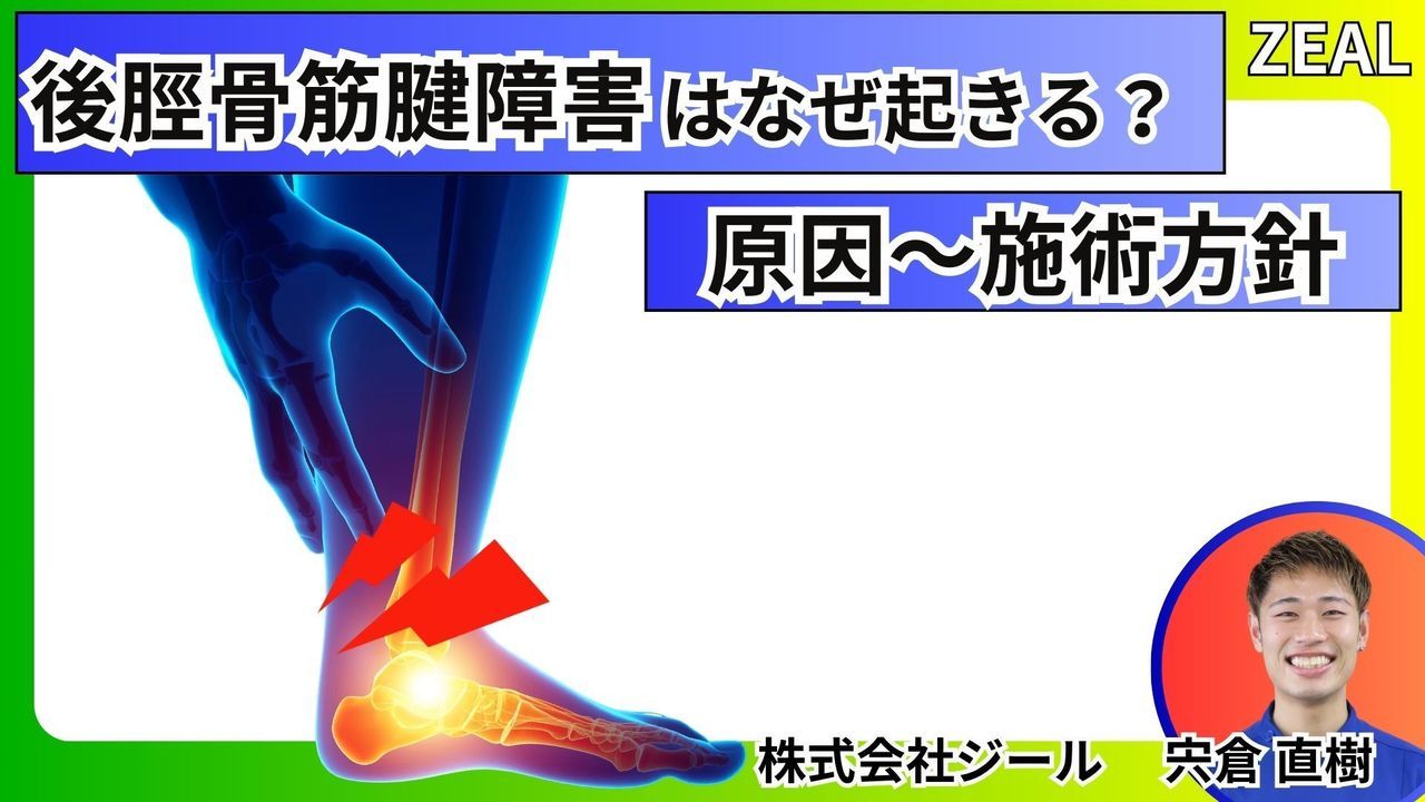後脛骨筋腱障害の原因