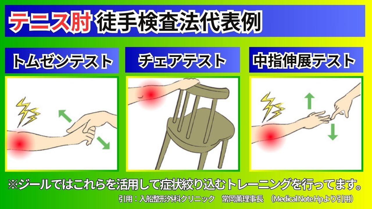 テニス肘（上腕骨外側上顆炎）の検査方法トムゼンテスト｜玉野市ジール鍼灸整骨院