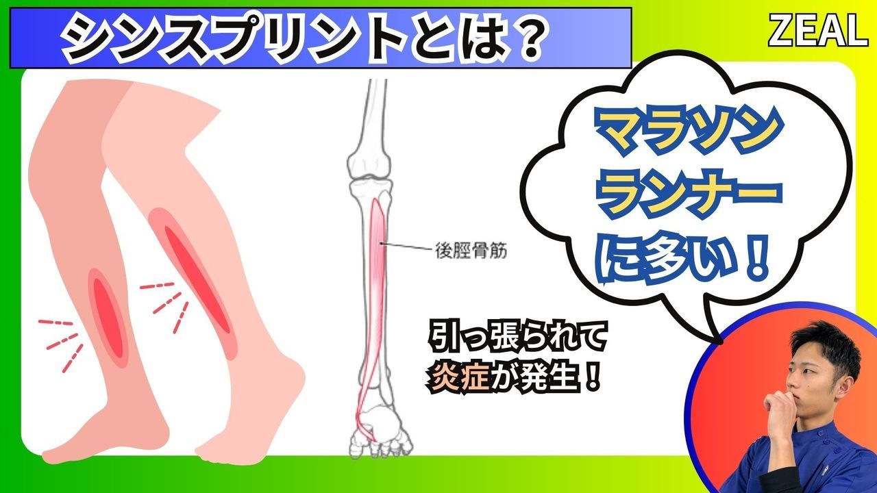 シンスプリントとは？｜玉野市ジール鍼灸整骨院