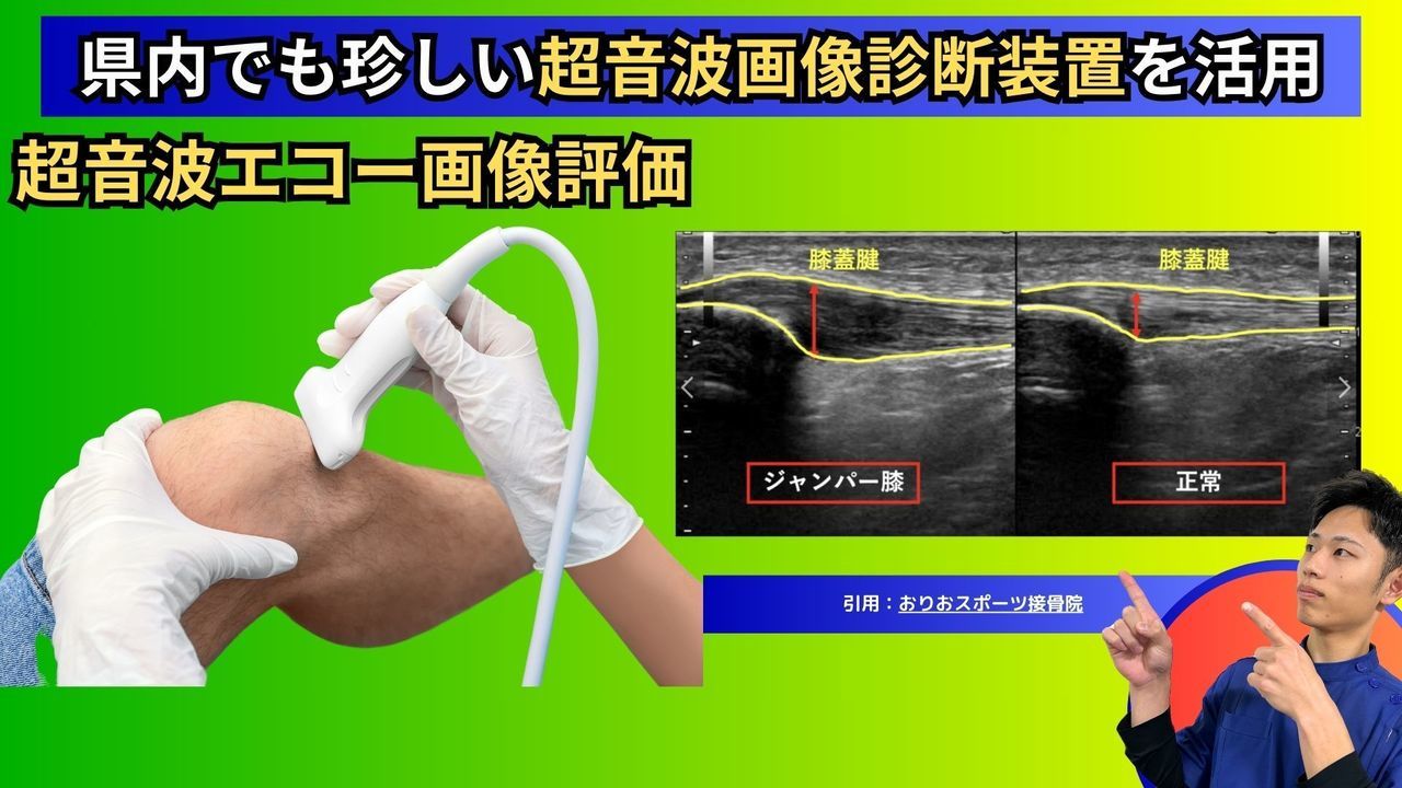 ランナー膝・腸脛靭帯炎のを画像診断します。｜玉野市ジール鍼灸整骨院