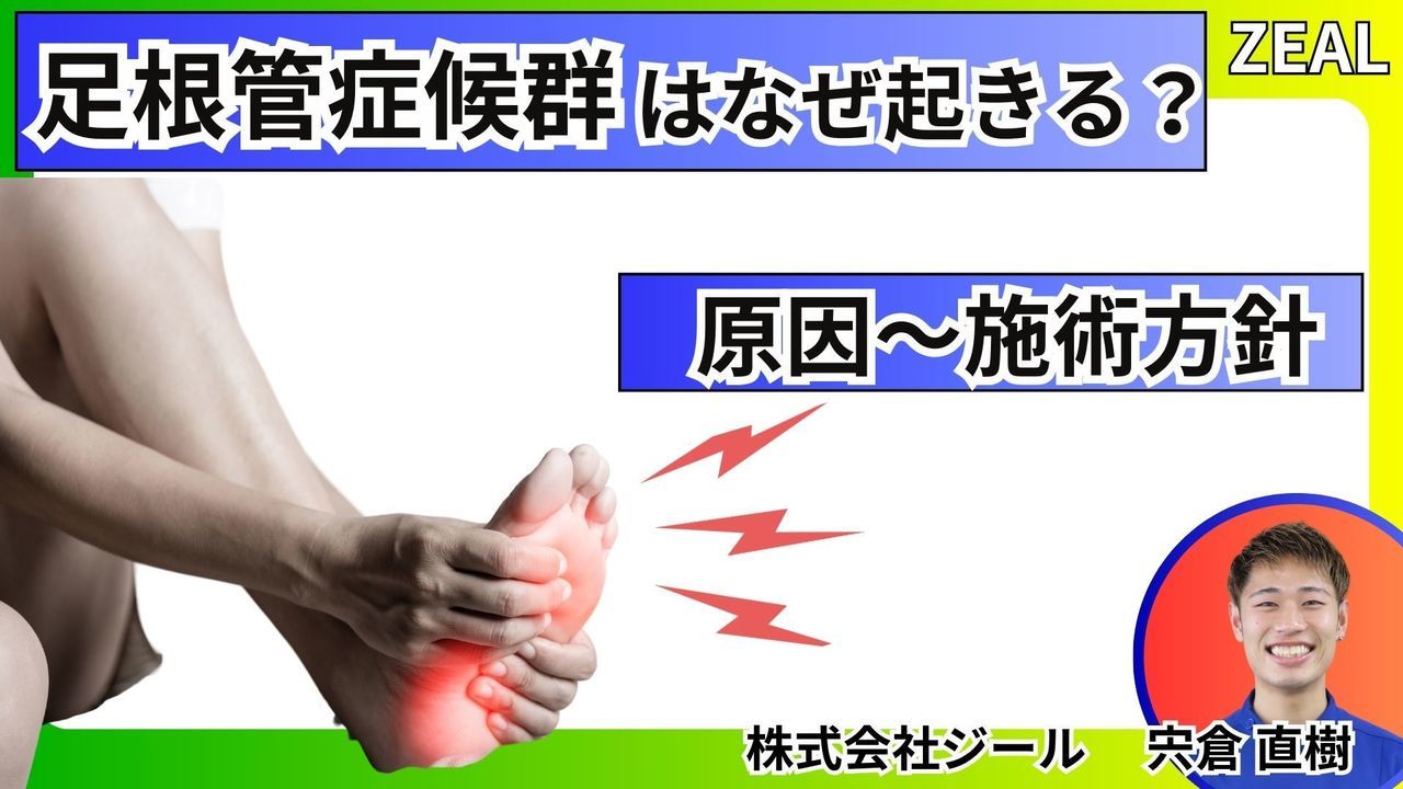 岡山県玉野市田井３丁目１１８８−１｜ジール鍼灸整骨院玉野院｜足根管症候群