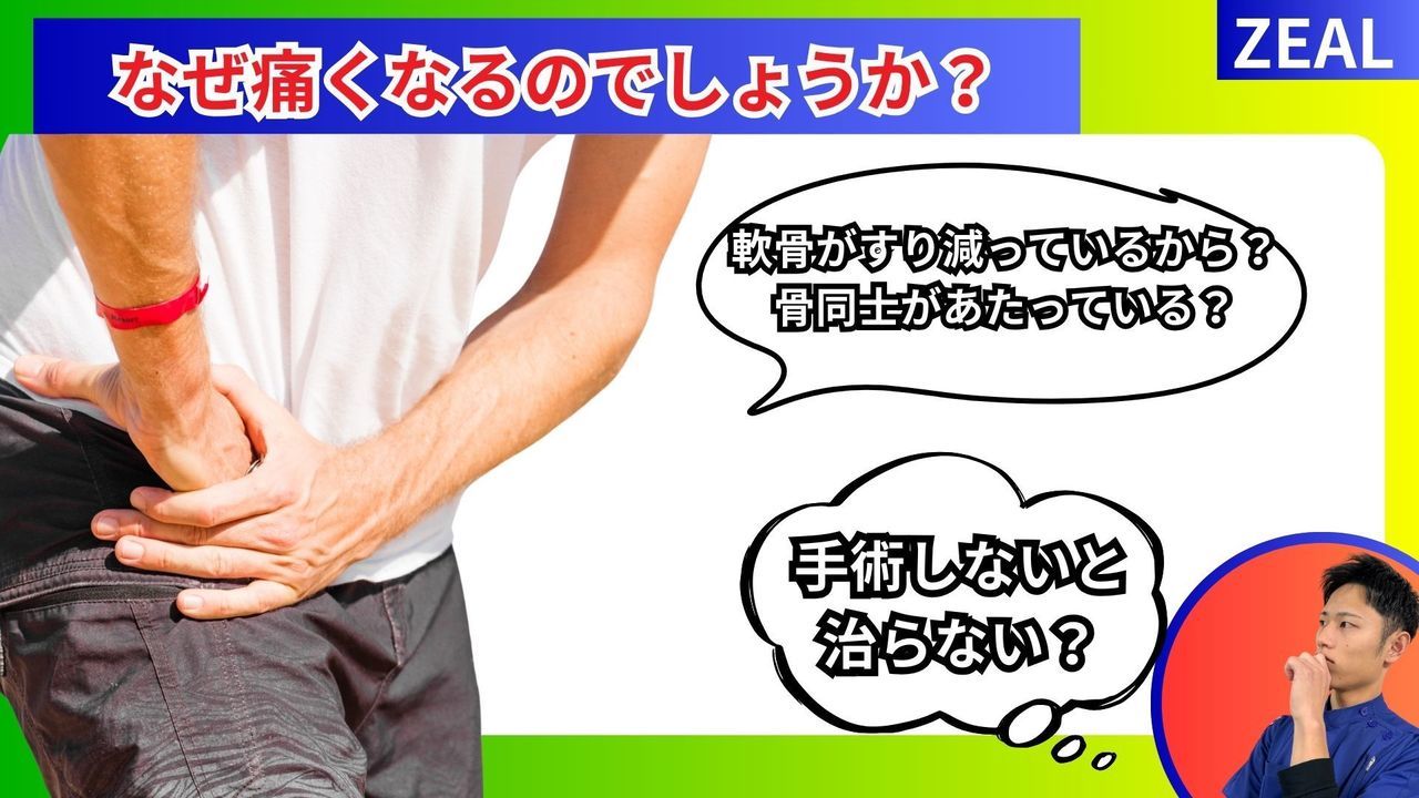 変形性股関節症はなぜ痛くなる？｜玉野市ジール鍼灸整骨院