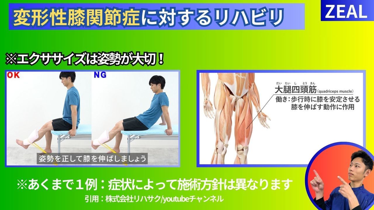 変形性膝関節症のセルフケア｜玉野市ジール鍼灸整骨院