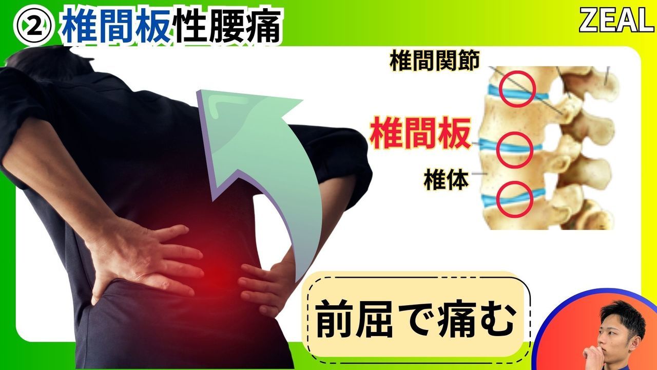 椎間板性腰痛｜玉野市ジール鍼灸整骨院