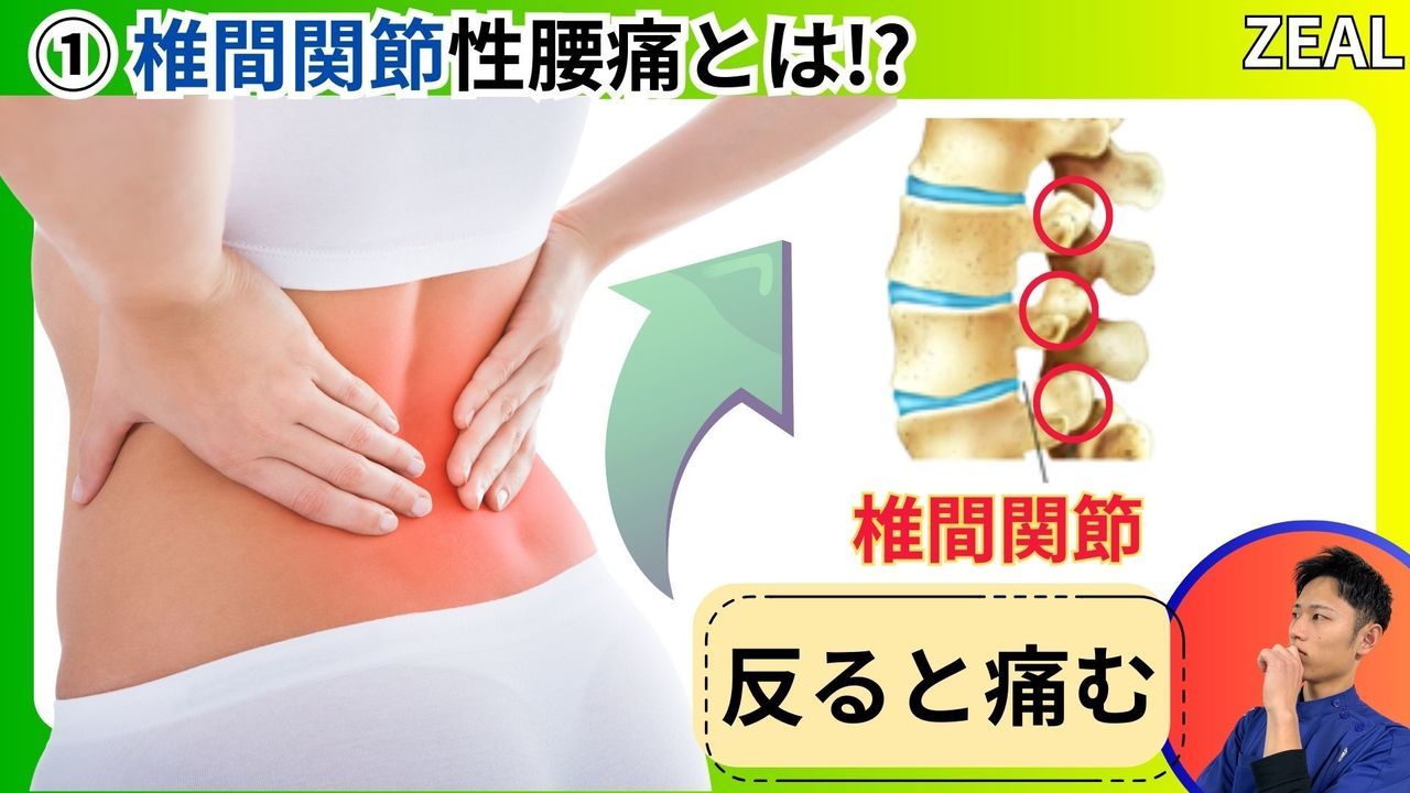 椎間関節性腰痛｜玉野市ジール鍼灸整骨院