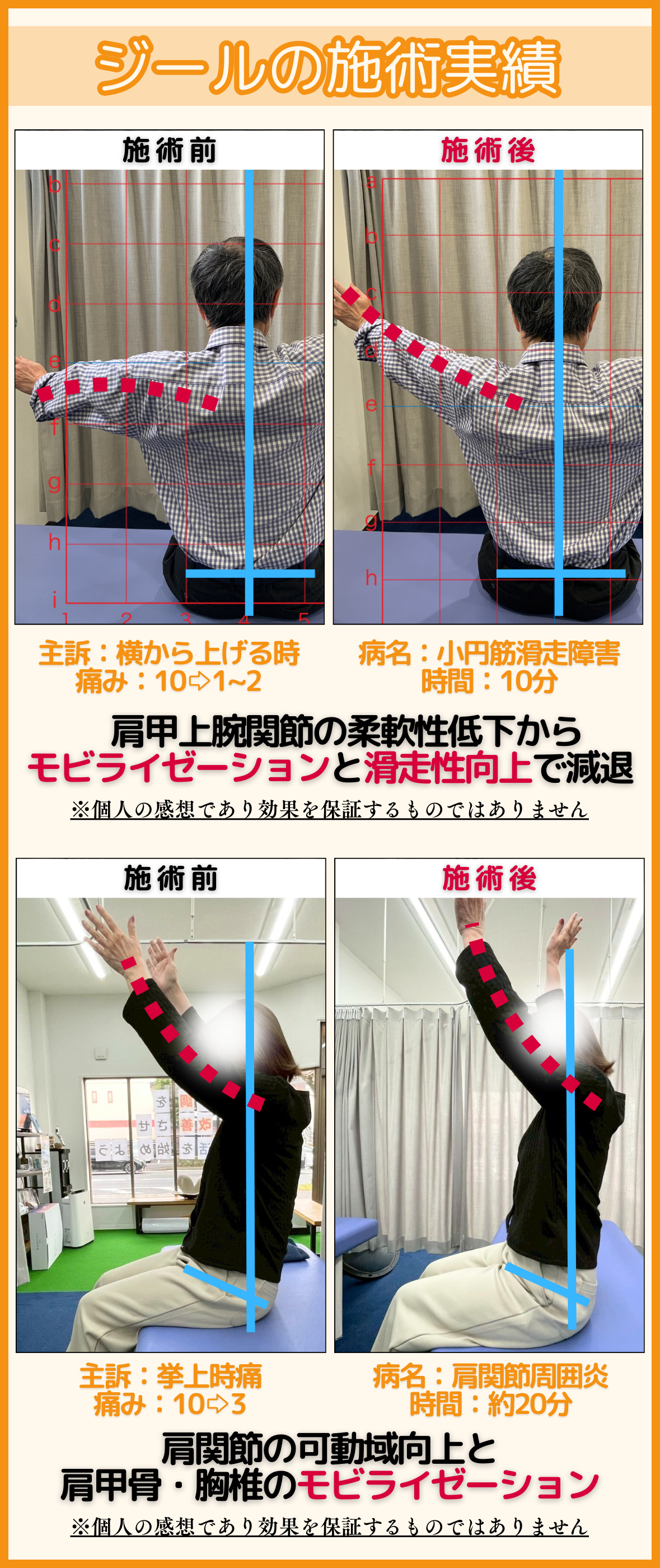 玉野市ジール鍼灸整骨院の施術実績