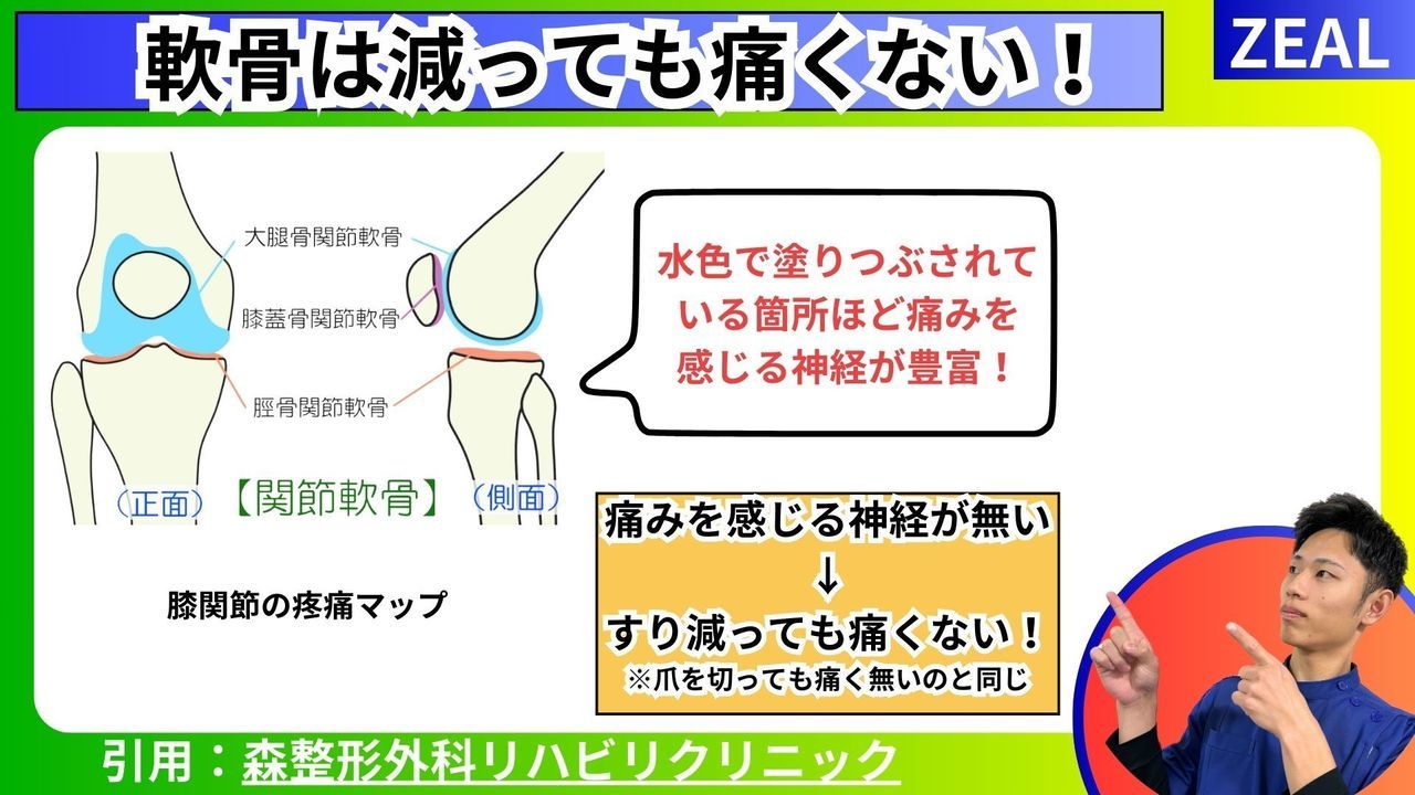 変形性膝関節症の誤った情報｜玉野市ジール鍼灸整骨院