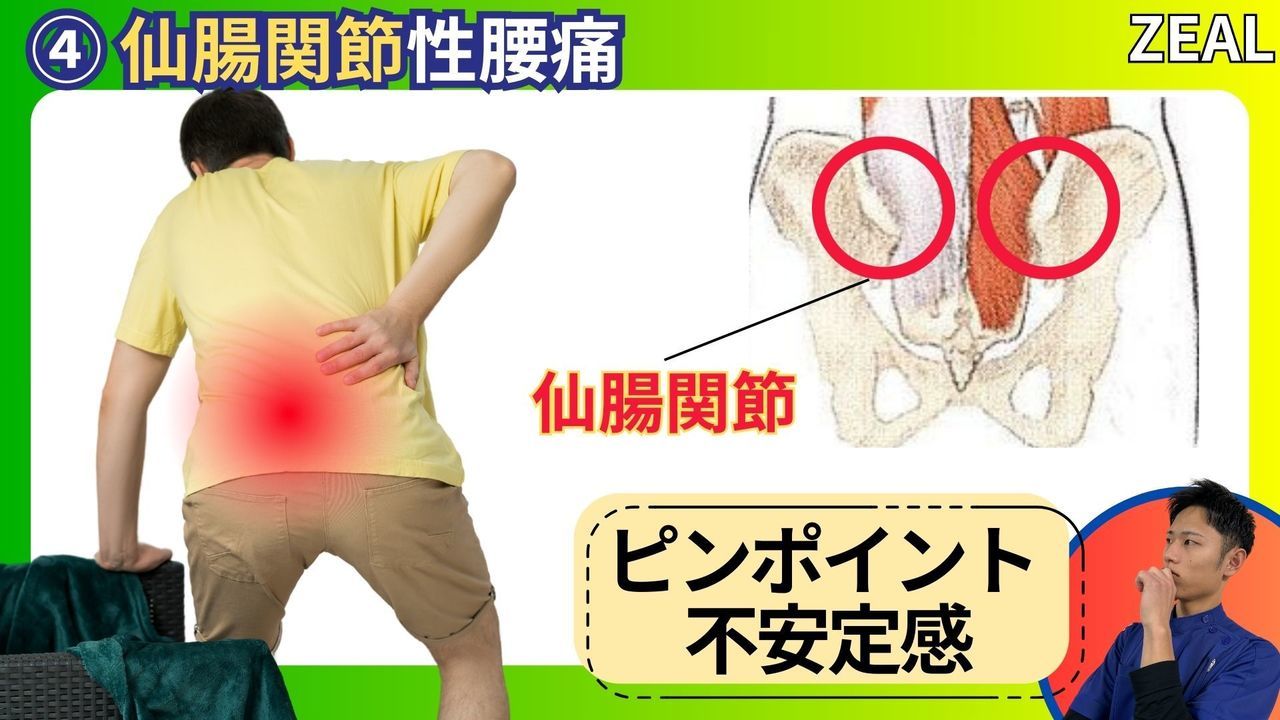 仙腸関節性腰痛｜玉野市ジール鍼灸整骨院